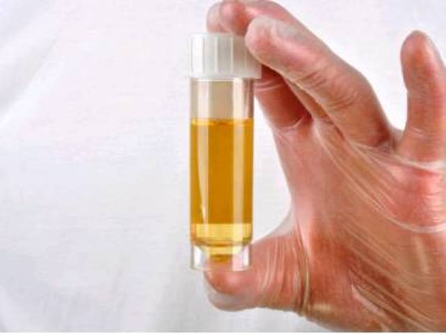 Pemeriksaan protein dalam urin