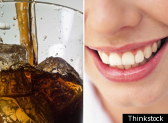 diet soda dan gigi