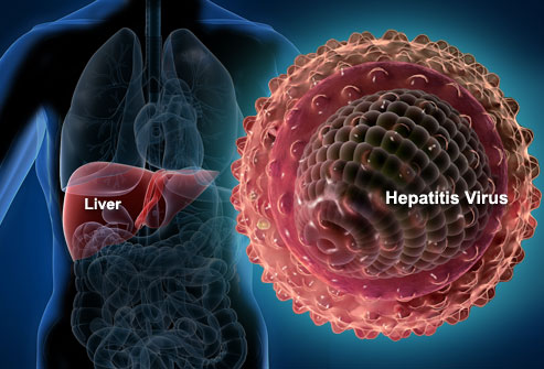 virus hepatitis
