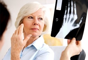 4 Gejala Tak Biasa Dari Rheumatoid Arthritis
