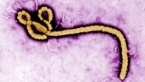 Mengenal Infeksi Virus Ebola